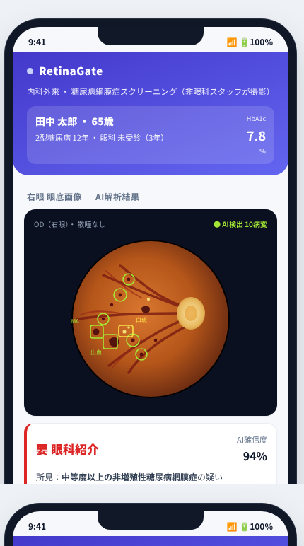 RetinaGate の画面イメージ