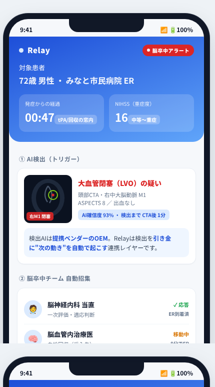 Relay の画面イメージ