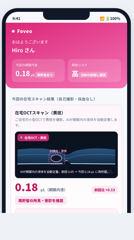Foveo の画面イメージ