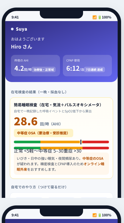 Suya の画面イメージ