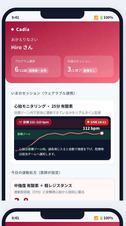 Cadia の画面イメージ
