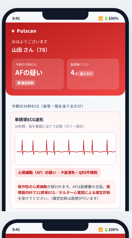 Pulscan の画面イメージ