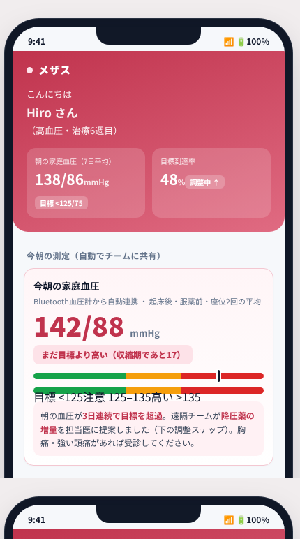 メザス の画面イメージ