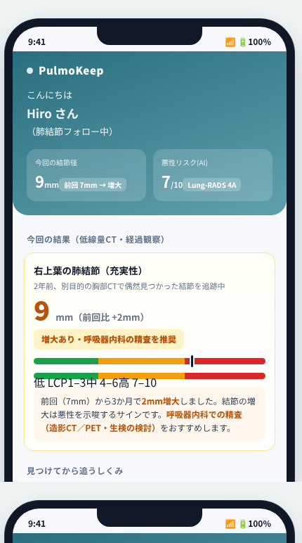 PulmoKeep の画面イメージ