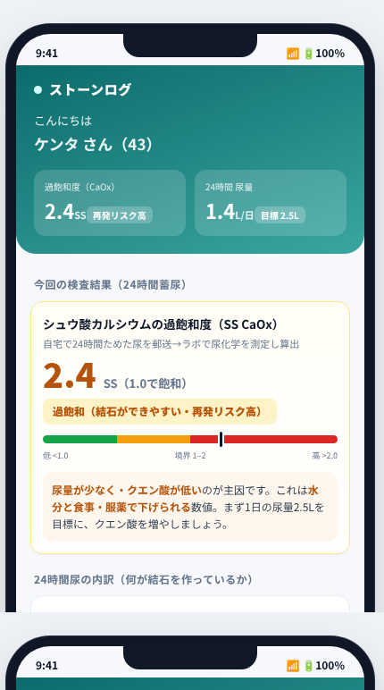 ストーンログ の画面イメージ