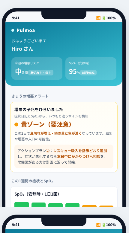 Pulmoa の画面イメージ