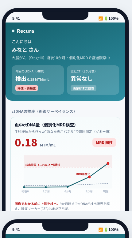 Recura の画面イメージ