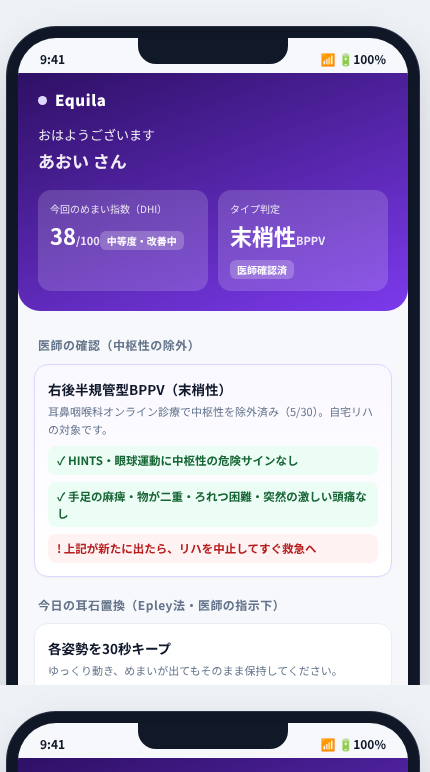 Equila の画面イメージ